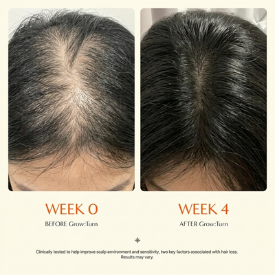 Hairderm Growth Serum