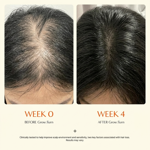 Hairderm Growth Serum